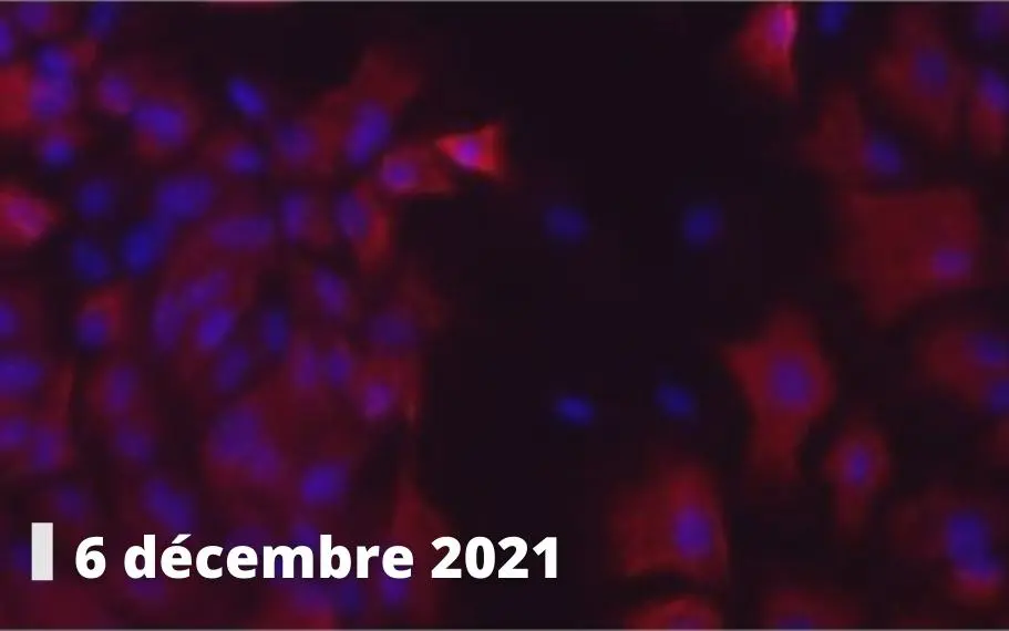Pasteur 2022