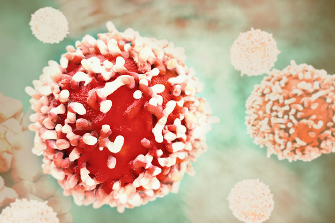 Cibler les cellules vieillissant prématurément sous l’effet de la radiothérapie pour prévenir l’émergence de cancers secondaires