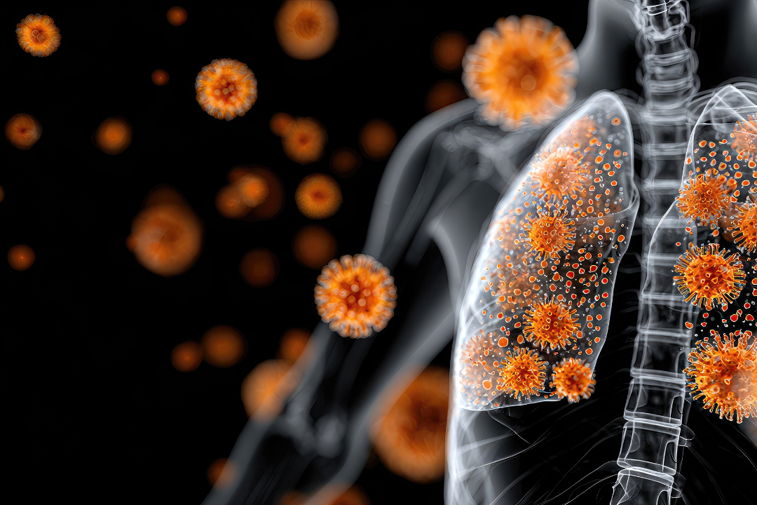 Infections respiratoires virales : vers une nouvelle méthode de prévention?