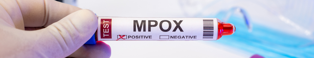 mpox_ vaccin mpox