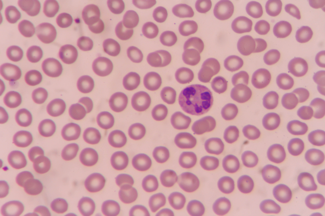 Les neutrophiles, cellules essentielles pour le traitement des pneumonies par immunothérapie innovante