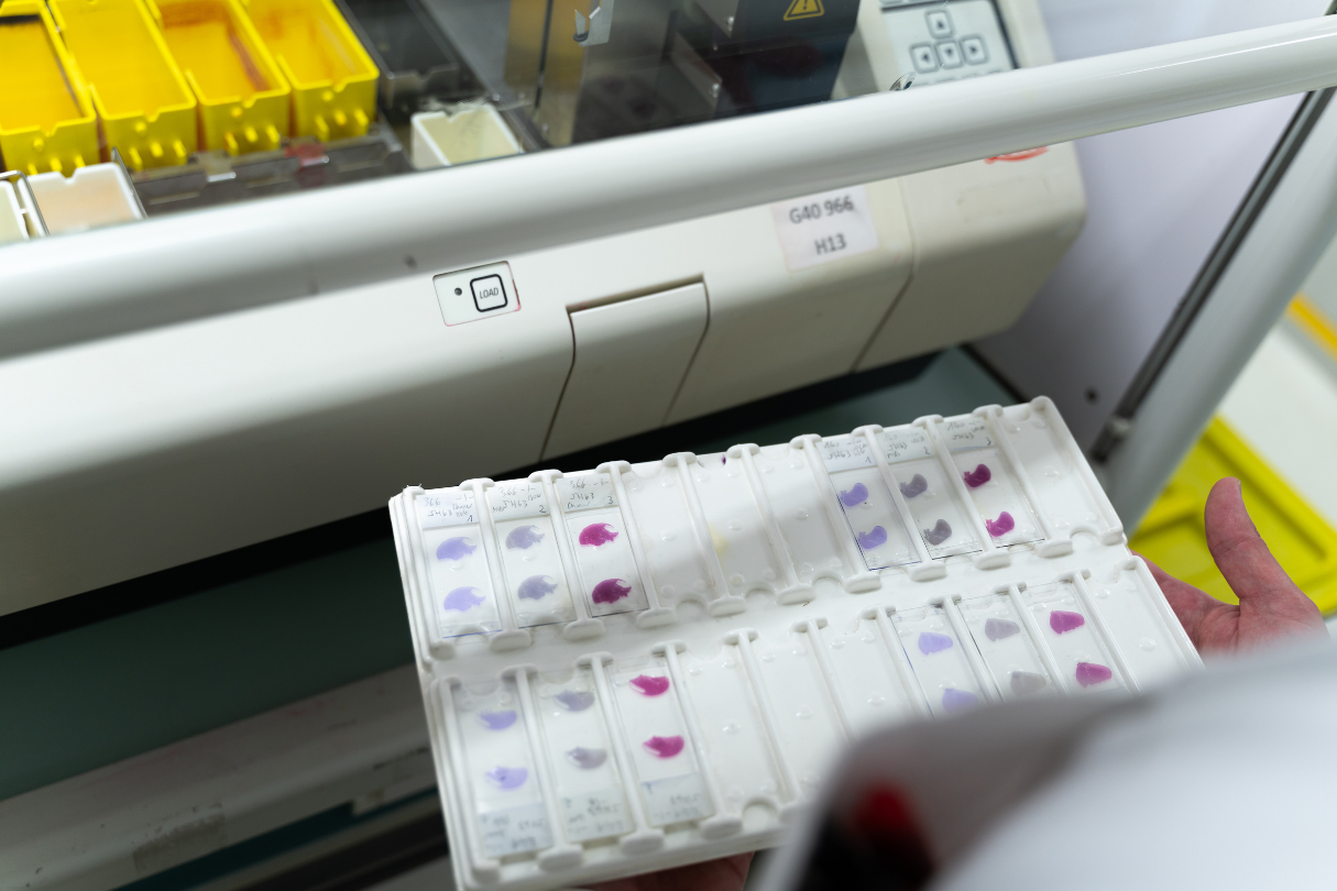 Des chercheurs Lillois découvrent une nouvelle cible thérapeutique contre les infections bactériennes