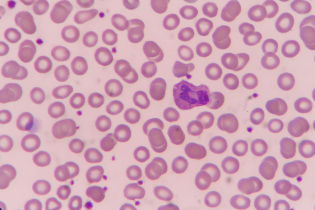 Les monocytes : un rôle clé dans la santé de nos vaisseaux sanguins