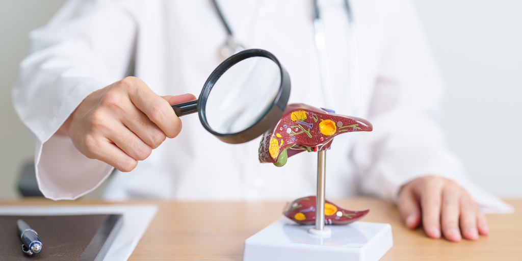 Hépatite B Foie infecté par hépatite B examiné par médecin à la loupe