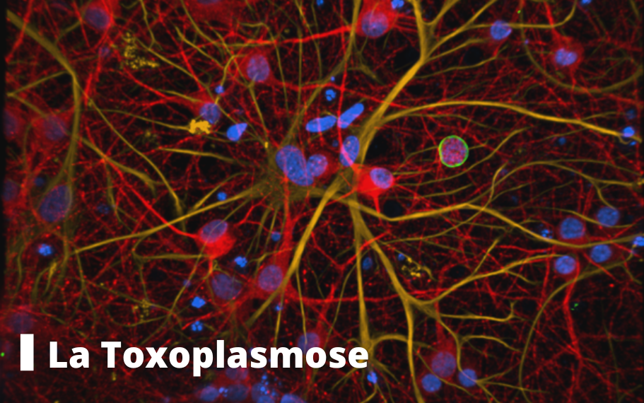 toxoplasmose (2)