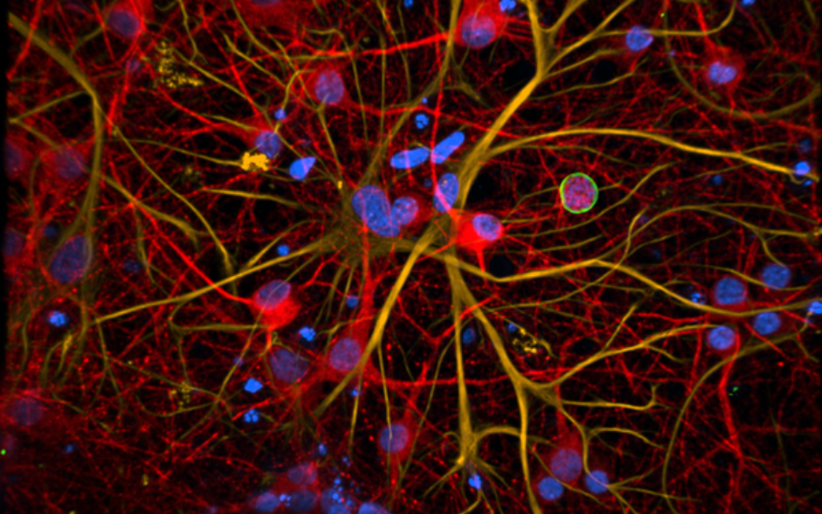 Neurones (en rouge) et cellules astrocytaires (en jaune) cultivés dans un système microfluidique et infectés par Toxoplasma gondii (kyste du parasite en vert). ©CIIL - API-B