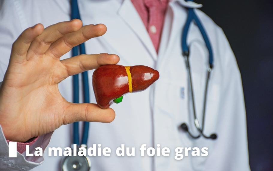 La maladie du foie gras Médecin en blouse blanche qui tient un foie entre ses doigts