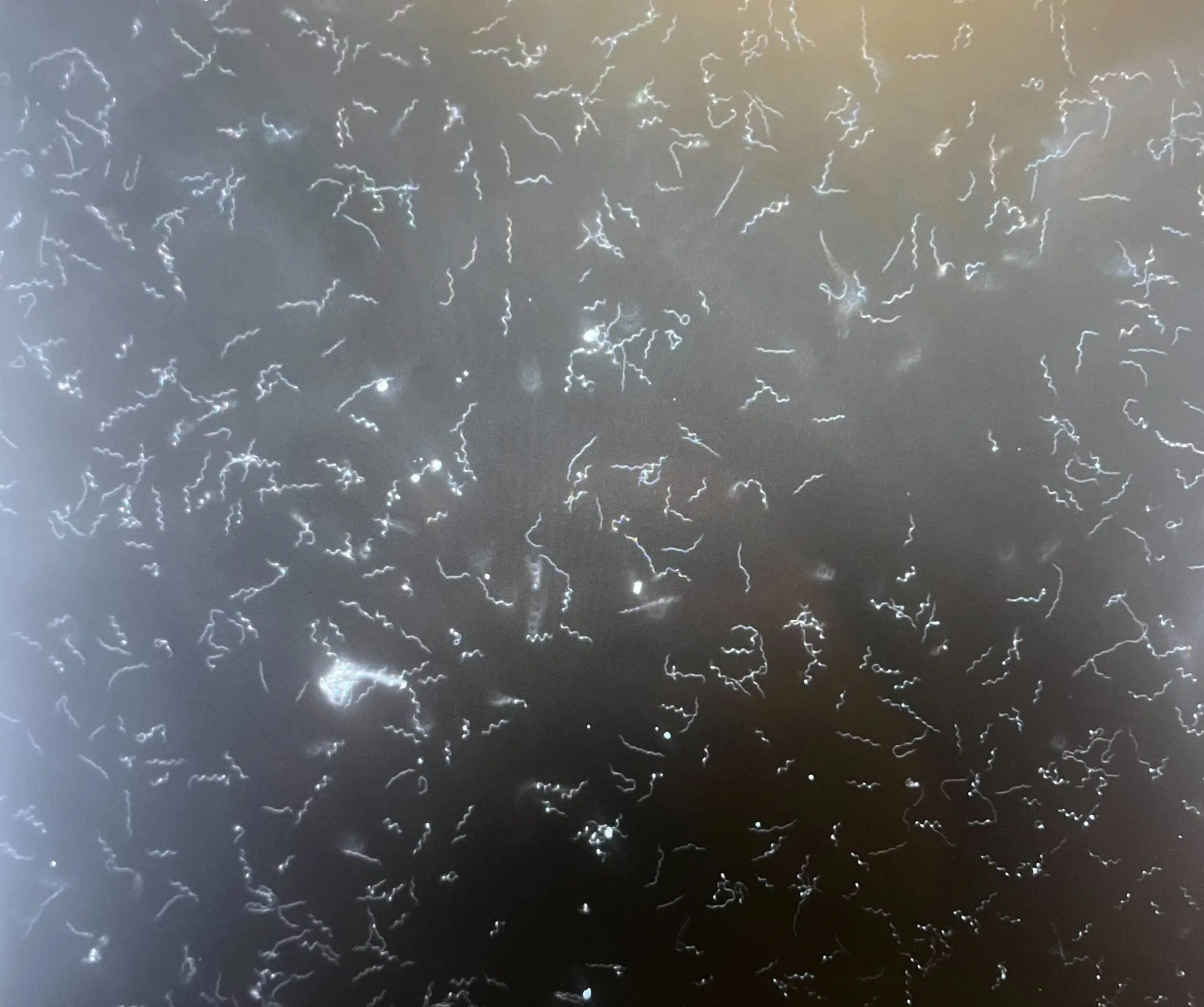 Borrelia burgdorferi, bactérie responsable de la maladie de Lyme, vue au microscope