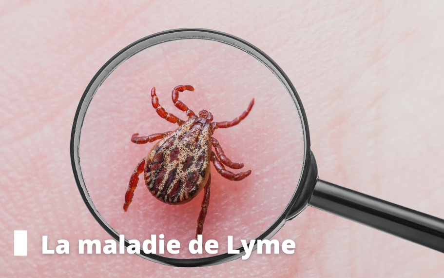 Maladie de Lyme Couple de personnes âgées faisant du sport accompagnés par une coach sportive