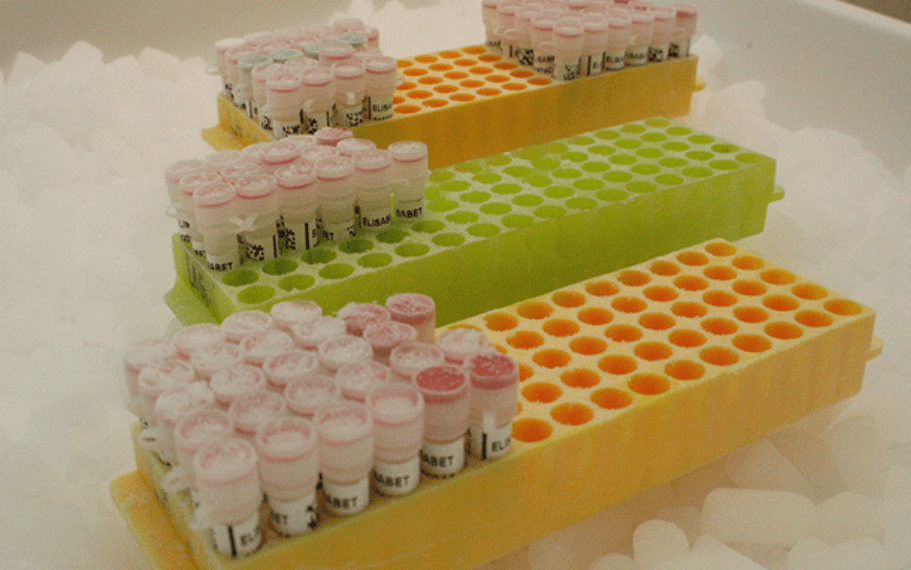 CRB – Centre de Ressources Biologiques