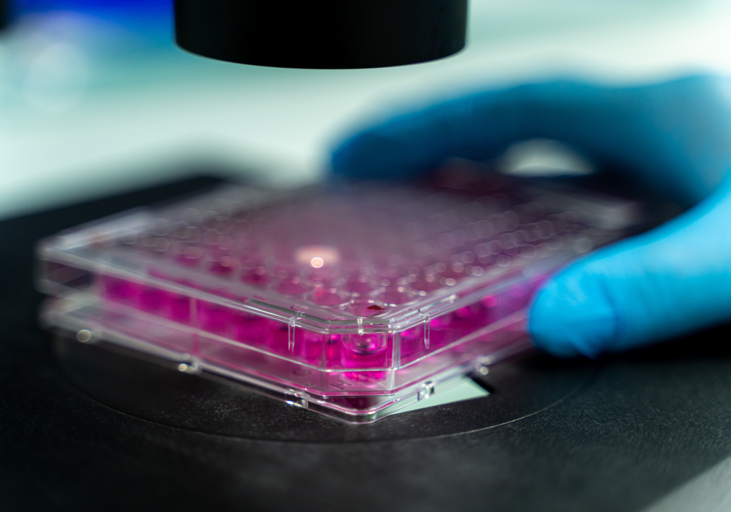 Infections nosocomiales