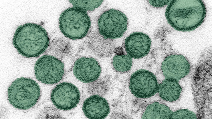 Hantavirus : un virus rare mais sous surveillance
