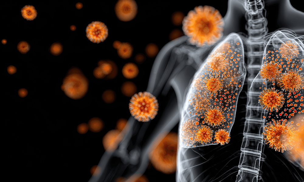 Une nouvelle stratégie thérapeutique pour réduire les séquelles associées aux pneumonies virales
