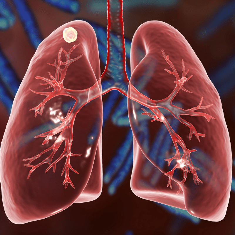 Un peptide des abysses ouvre de nouvelles perspectives contre les infections pulmonaires de la mucoviscidose