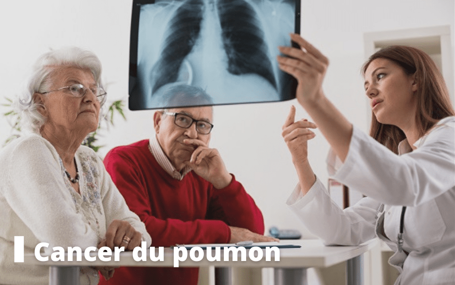 cancer du poumon dossier pasteur lille