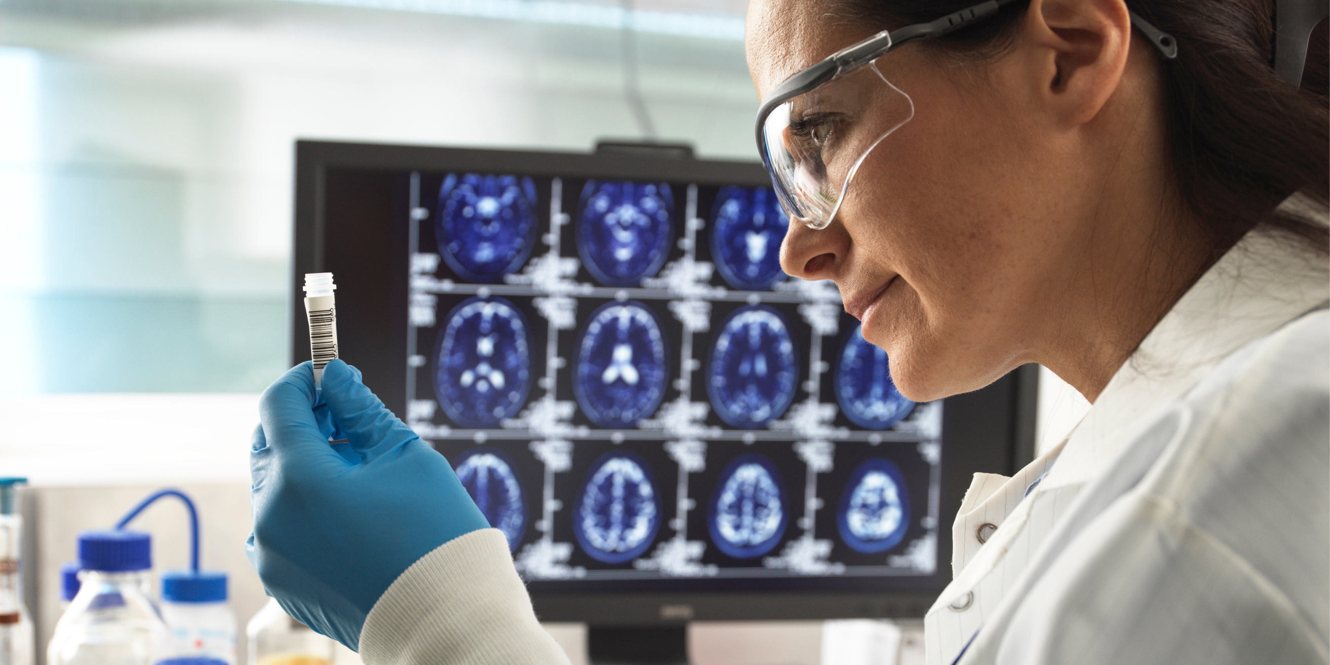Femme chercheur scientifique avec fiole dan sla main et radiologies du cerveau en arrière-plan