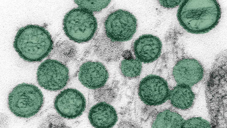 Hantavirus en France : surveillance, symptômes et prévention