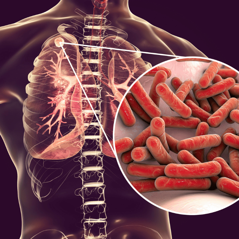 Une nouvelle cible thérapeutique contre la tuberculose identifiée par des équipes Lilloises